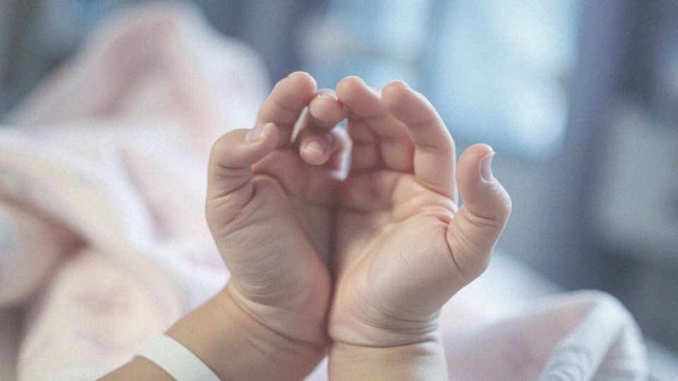 Jakie są objawy zespołu Downa u noworodków?